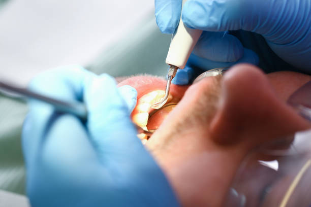 Best Broken or Cracked Tooth Emergency Dentist in Hotchkiss, CO